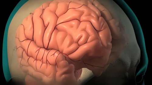 医疗手术3d动画